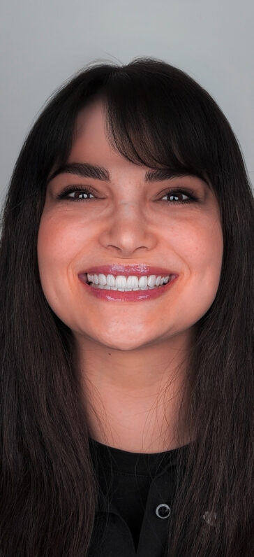 Porcelain Veneers
