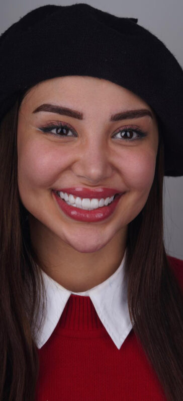 Smile Design
